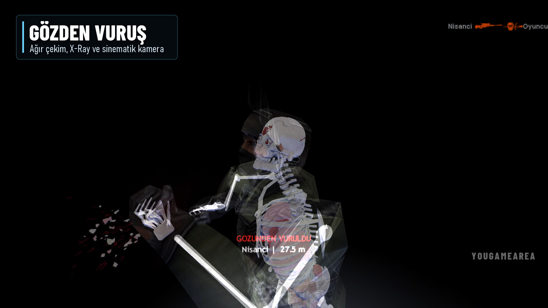 xray-goz.jpg