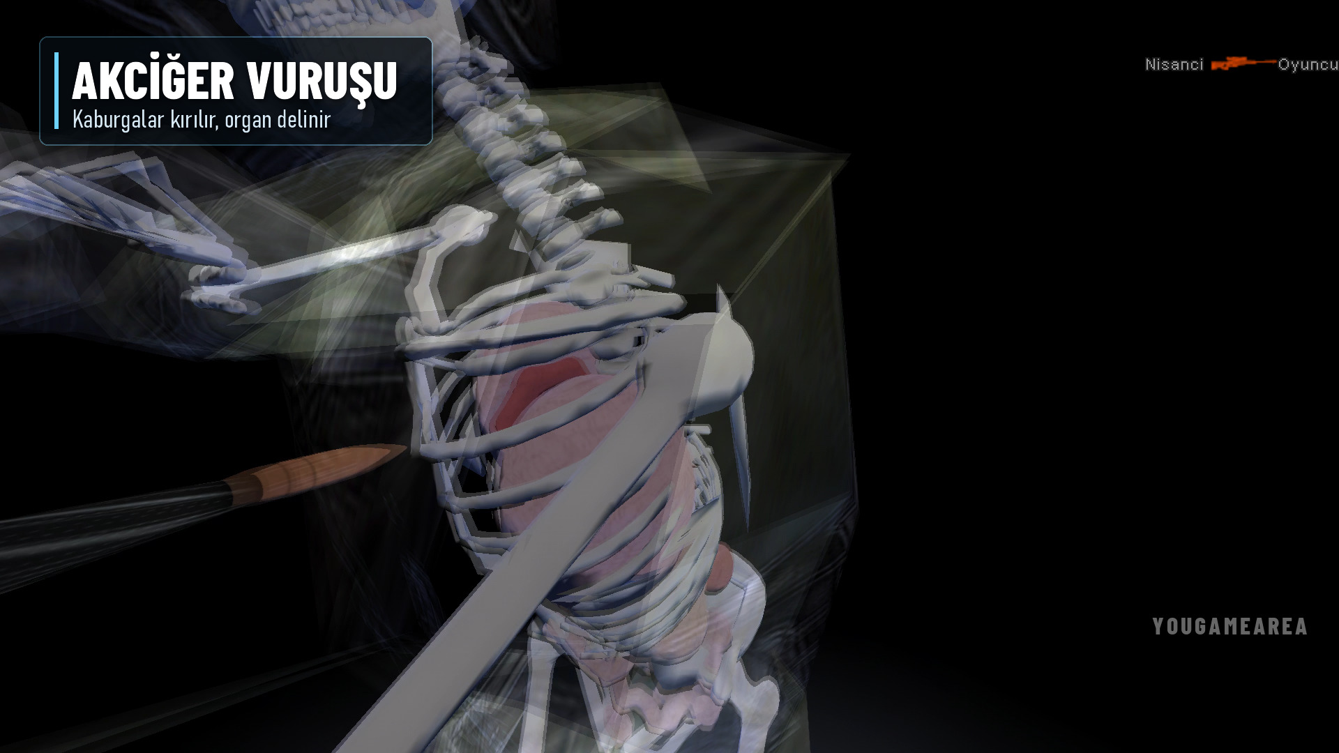 xray-akciger.jpg
