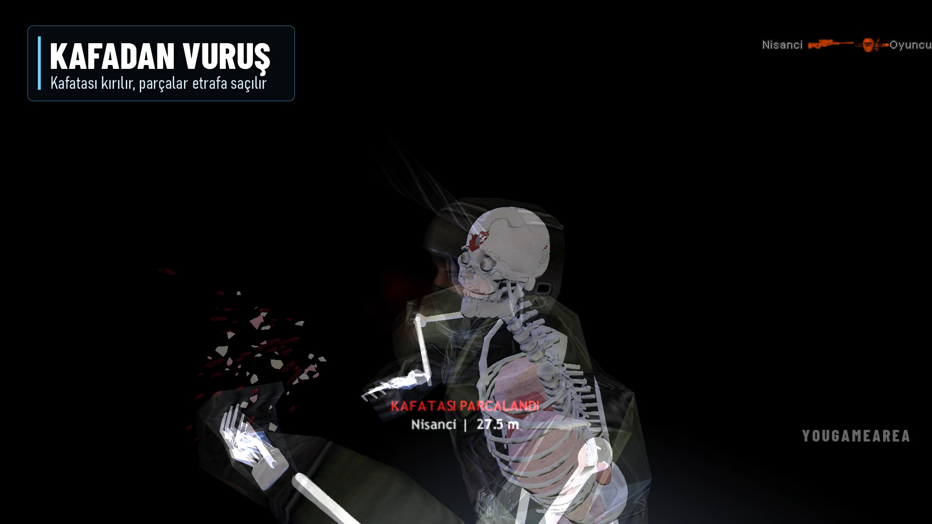 xray-kafatasi.jpg